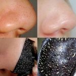 بلک ماسک پیل آف بینی - تصویر 3